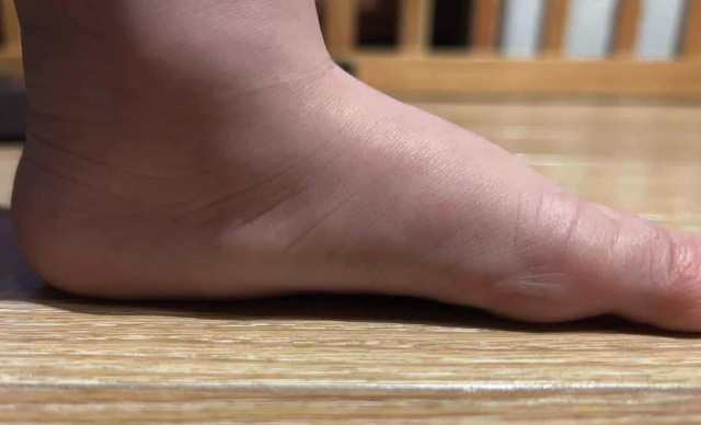 着用後 足底圧